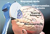 Η μαγνητική διέγερση βοηθά άτομα με κατάθλιψη | tovima.gr