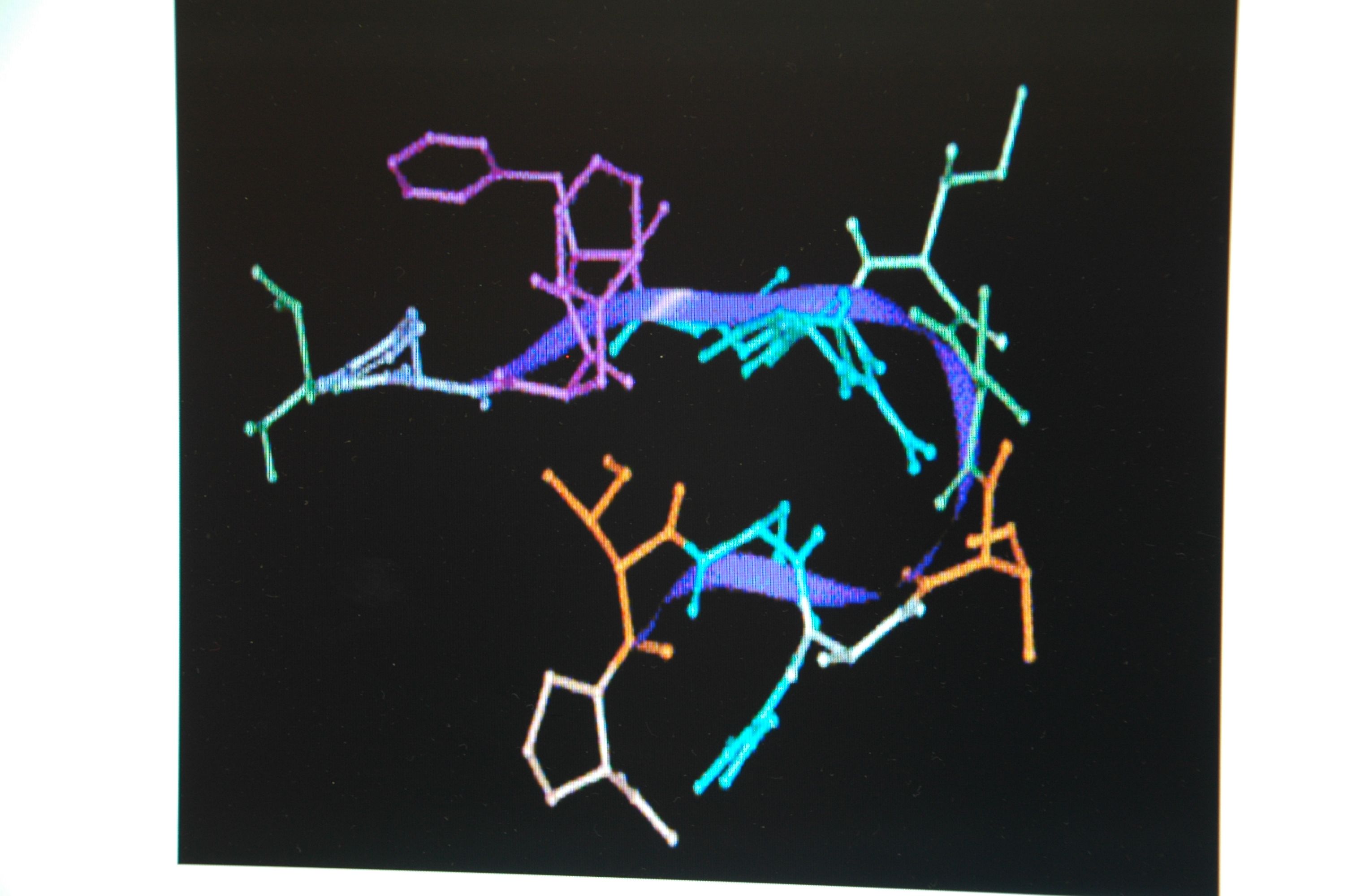 Εκστρατεία ενημέρωσης για τη σκλήρυνση