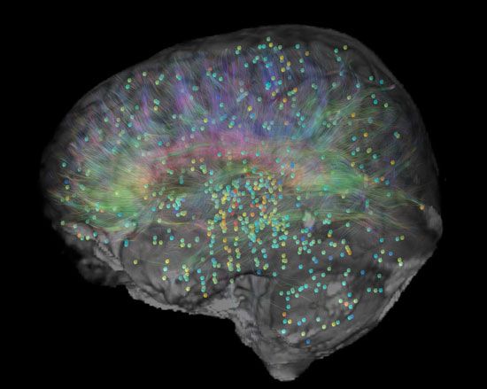Ο νέος ηλεκτρονικός χάρτης του εγκεφάλου