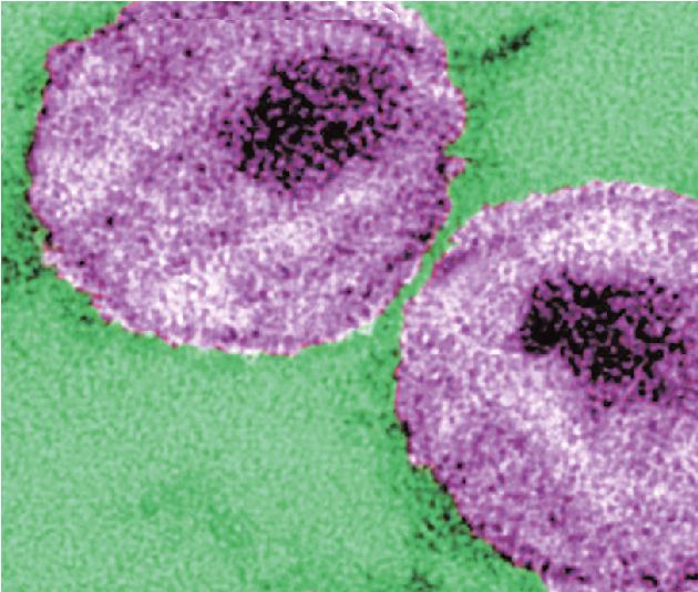 Το AIDS είναι εδώ κι ας το ξεχάσαμε