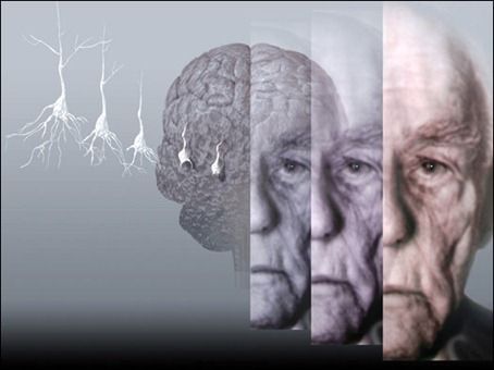 Αλτσχάιμερ: διάγνωση 10 χρόνια πριν