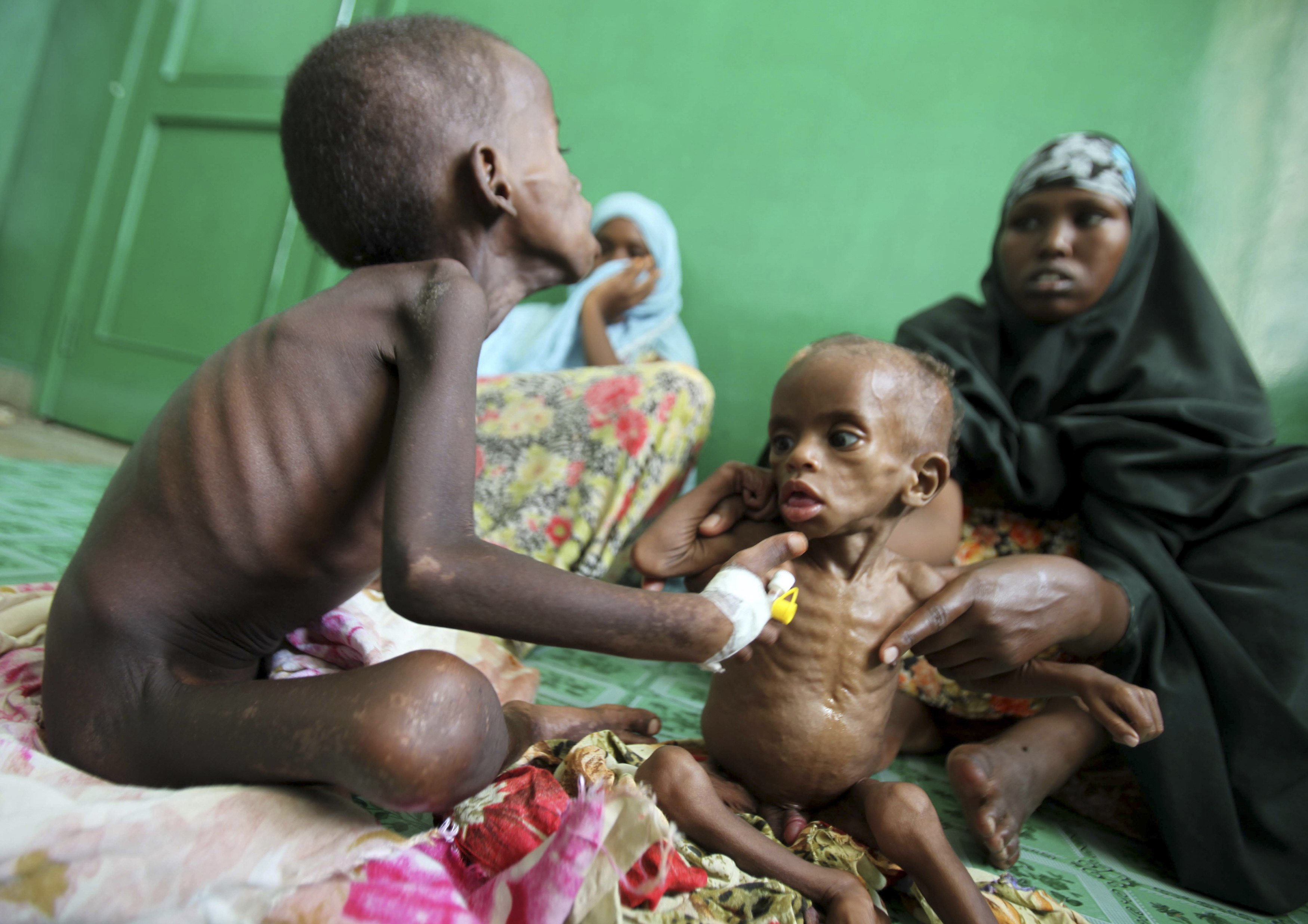 AFR10 SOMALIA FAMINE 0804 11