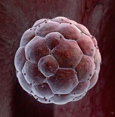 Κλωνοποίηση «γεννά» ανθρώπινα εμβρυϊκά βλαστοκύτταρα