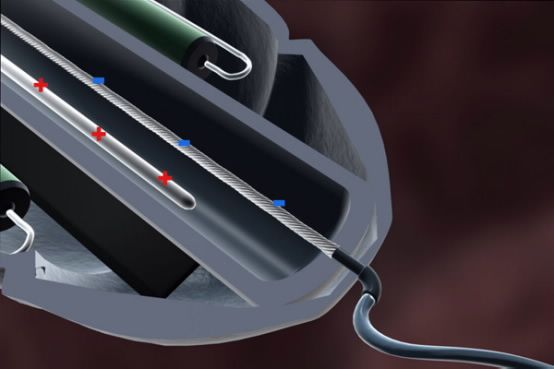 «Τεχνητοί μύες» φέρνουν επανάσταση στη νανομηχανική