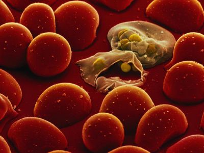 Βρέθηκε η «αχίλλειος πτέρνα» του παρασίτου της ελονοσίας