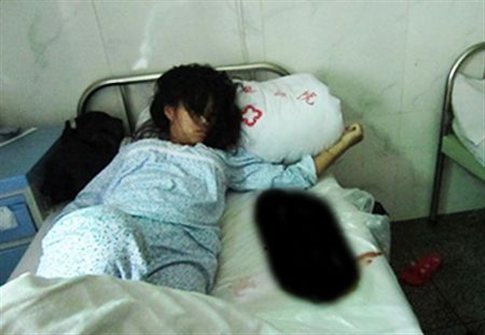 Φρίκη στην Κίνα με βίαιη άμβλωση σε έγκυο επτά μηνών
