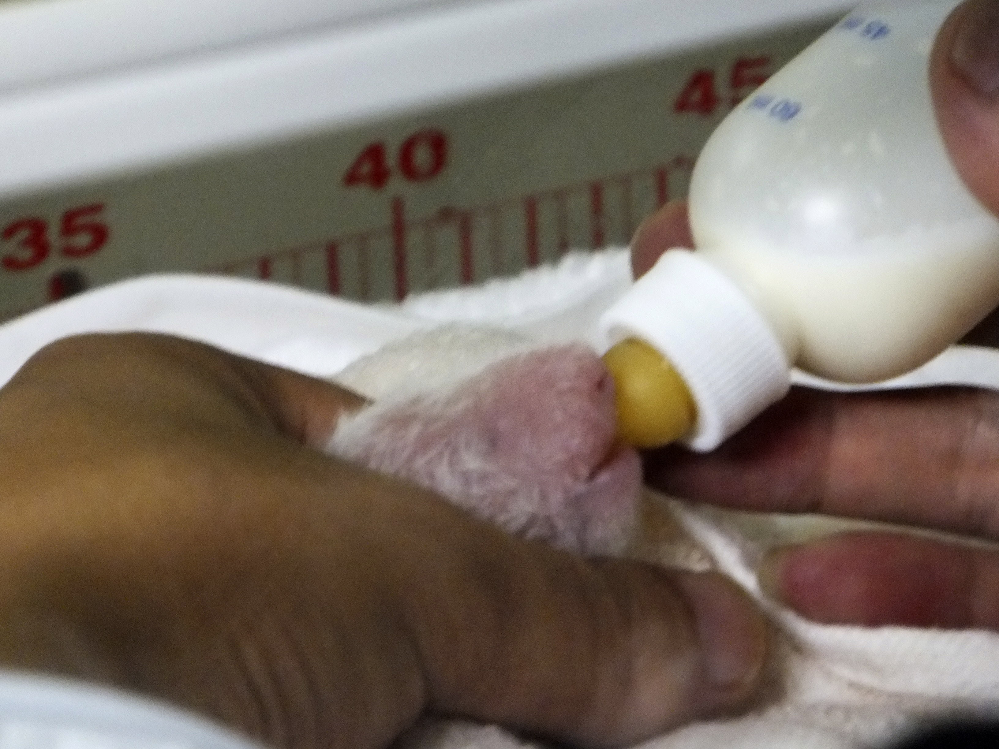 Τόκιο: Πέθανε από πνευμονία το μωρό πάντα που γεννήθηκε την Πέμπτη