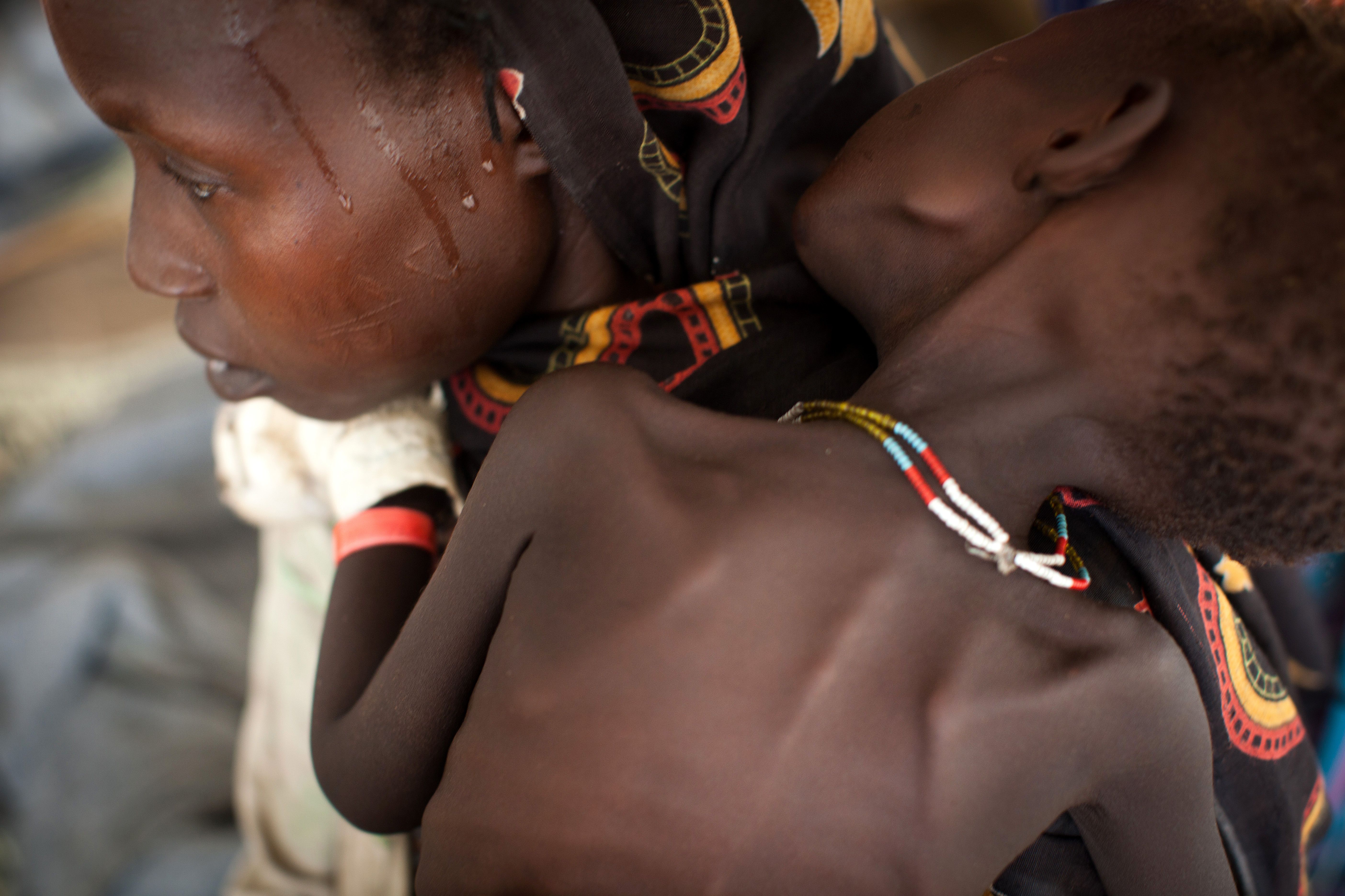 Νότιο Σουδάν: Τρομακτική η θνησιμότητα στους καταυλισμούς προσφύγων
