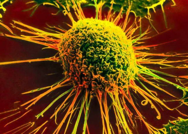 Γονίδιο εξολοθρεύει «εκ των έσω» τον καρκίνο