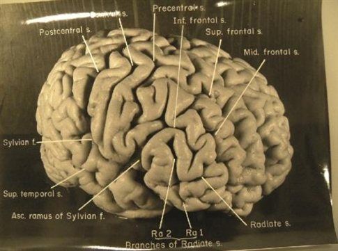 Αϊνστάιν: ένας ιδιαίτερος εγκέφαλος