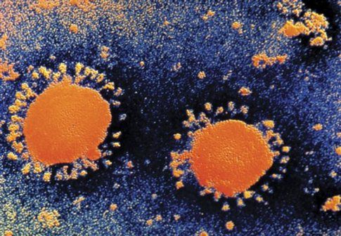 Νέα κρούσματα ιού που μοιάζει με το SARS στη Μέση Ανατολή