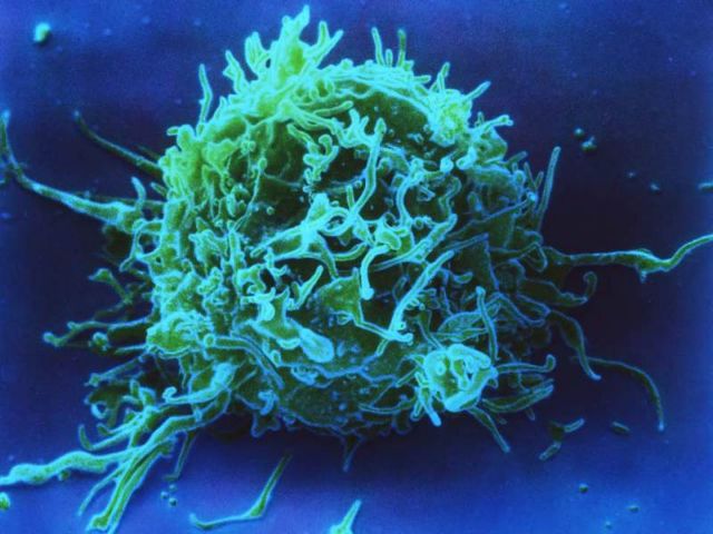 Κύτταρα εργαστηρίου εξολοθρεύουν τον καρκίνο