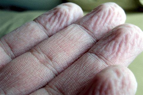 Γιατί τα ανθρώπινα δάχτυλα ζαρώνουν στο νερό; | tovima.gr