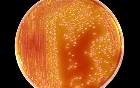 Γήνια μικρόβια αντέχουν σε αρειανές συνθήκες | tovima.gr