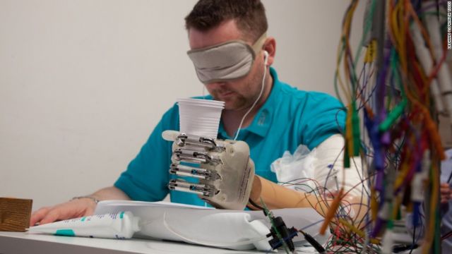 Ρομποτικό ακροδάχτυλο χαρίζει αφή σε ασθενή
