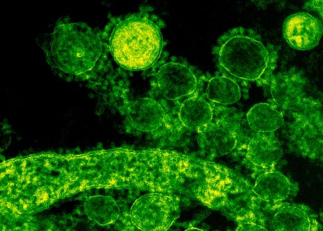 Πώς ο νέος κορονοϊός μολύνει τα ανθρώπινα κύτταρα