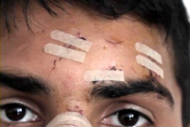 Οι Γιατροί του Κόσμου κατέγραψαν 75 περιστατικά ρατσιστικής βίας