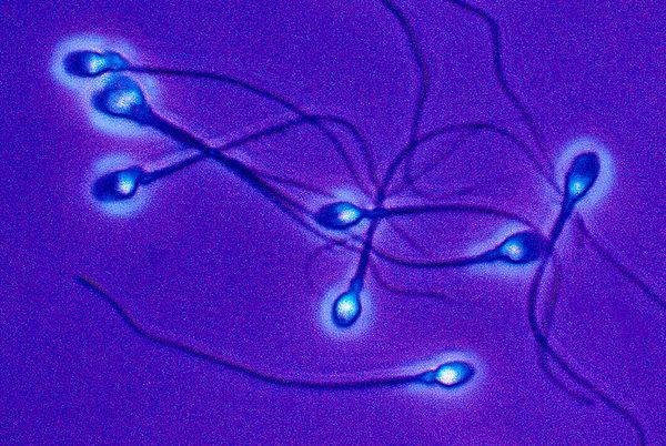 Τηλεκατευθυνόμενα σπερματοζωάρια κολυμπούν σε μαγνητικά πεδία