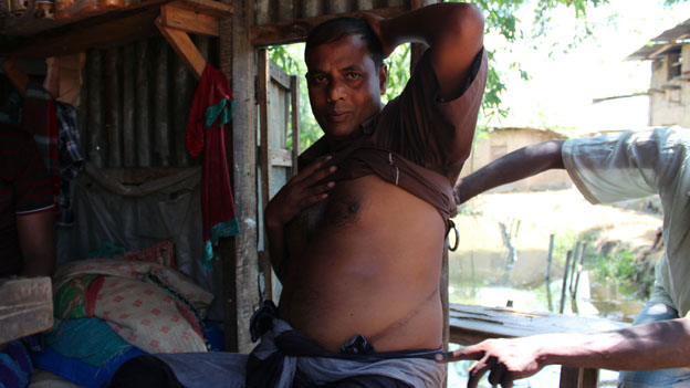 Μπαγκλαντές: Πωλούν τα οργανά τους για να ξεπληρώσουν τα χρέη τους