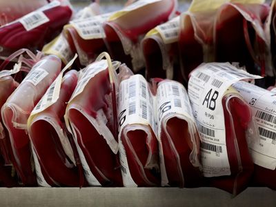 Εξοικονόμηση €15 εκατ. από τον διαγωνισμό για τον ελέγχο του αίματος