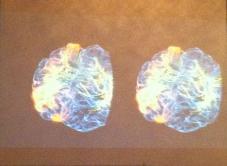 «Γυάλινος εγκέφαλος» για εξερεύνηση σε πραγματικό χρόνο