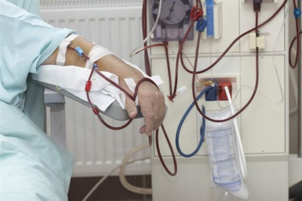 Προκαταρκτική εξέταση για επικίνδυνα φίλτρα αιμοκάθαρσης | tovima.gr