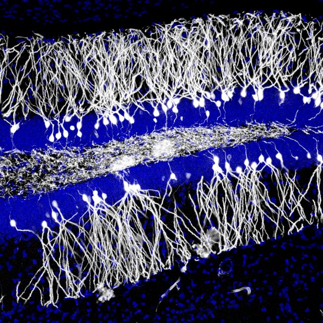 Νέοι νευρώνες «σβήνουν» τις παλιές αναμνήσεις