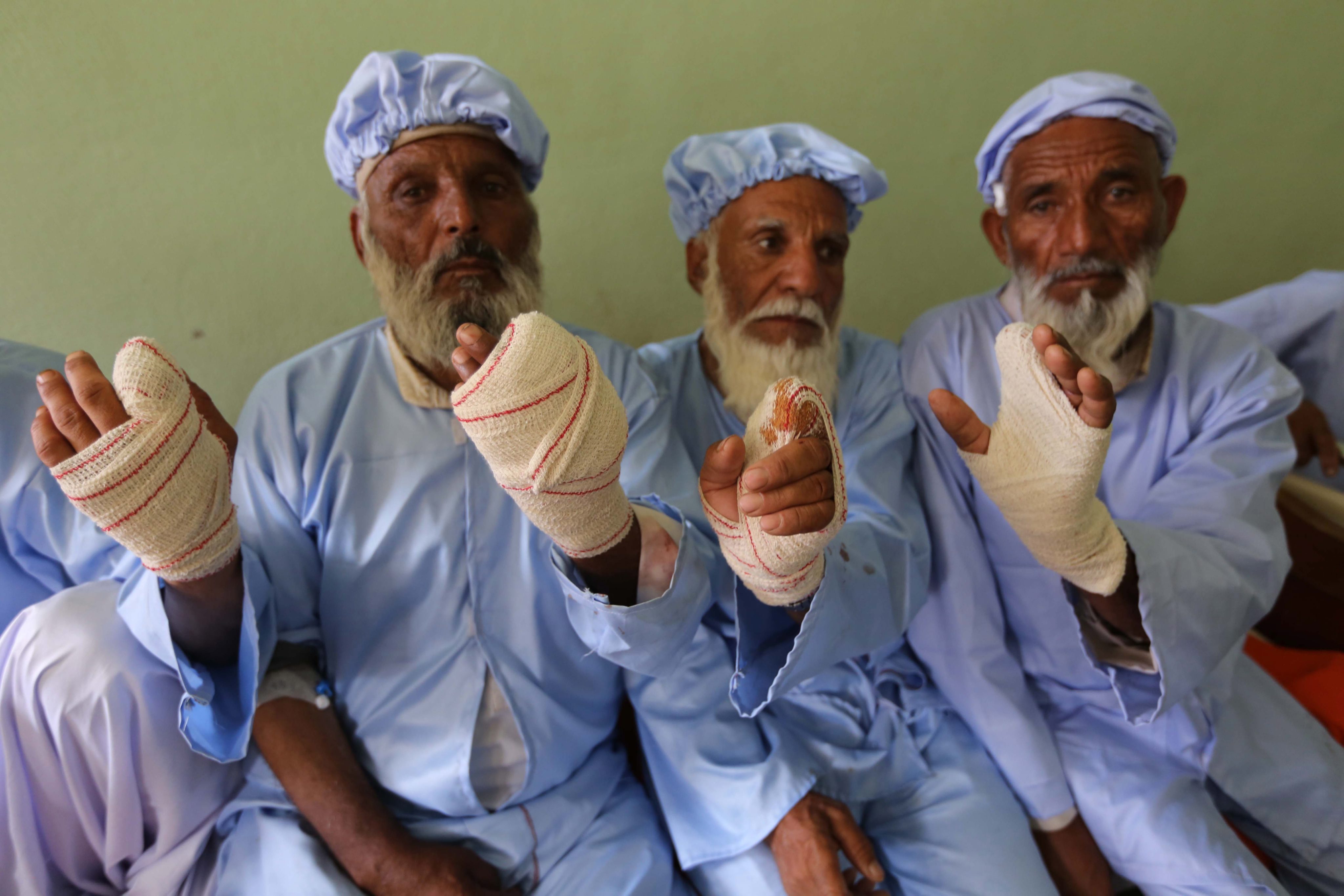 Αφγανοί τιμωρήθηκαν με ακρωτηριασμό από Ταλιμπάν επειδή ψήφισαν