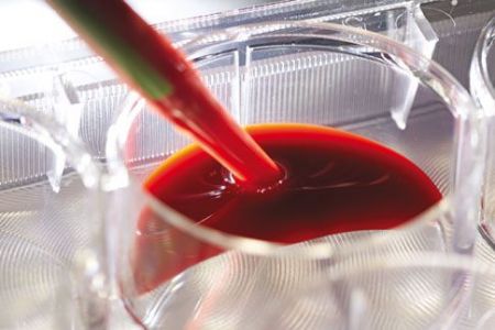 Εξέταση «βρίσκει» την ομάδα αίματος σε δευτερόλεπτα