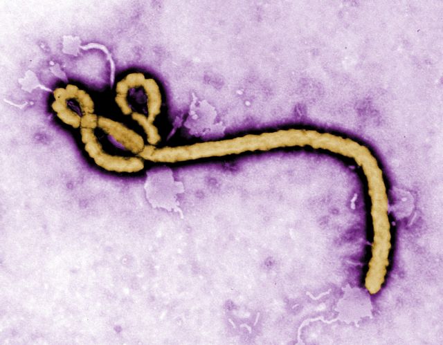 Ελπιδοφόρα πειραματική θεραπεία για τον Έμπολα