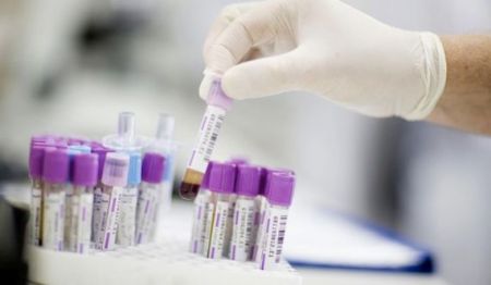 Μελέτη επιβεβαιώνει την αξία του τεστ PSA στη θεραπεία του καρκίνου προστάτη