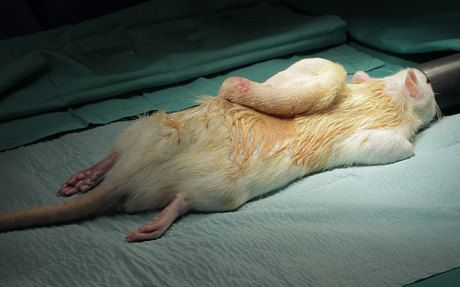 Τυπωμένα εμφυτεύματα για παιδιά που γεννήθηκαν χωρίς αφτιά