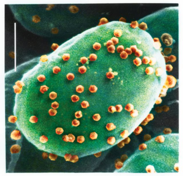 Ιός που μολύνει φύκη ίσως προσβάλλει και τον άνθρωπο