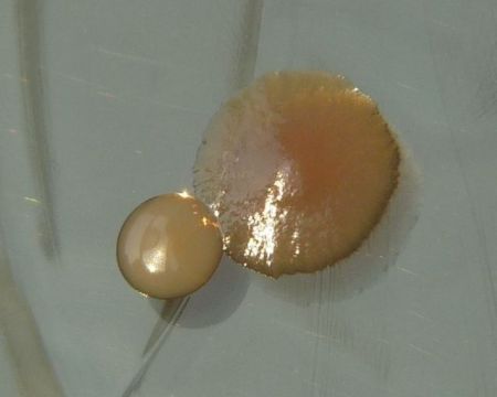 Βακτήριο με αίσθηση της «αφής» μολύνει σχεδόν τα πάντα