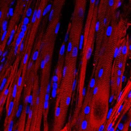 Καλλιεργημένοι ανθρώπινοι μύες αρχίζουν τις συσπάσεις