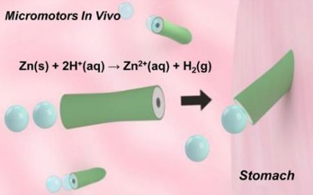 «Μηχανικό» ταξίδι στο… σώμα