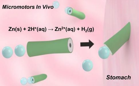 «Μηχανικό» ταξίδι στο… σώμα