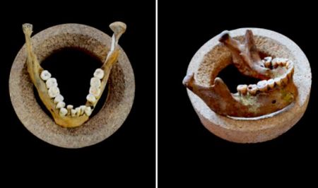 Πότε τα ανθρώπινα δόντια άρχισαν να στραβώνουν