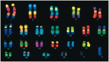 Η ασθενής που αυτοϊάθηκε χάρη σε… γενετικό ατύχημα