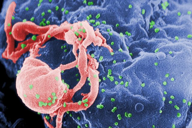 Επιθετικό στέλεχος του HIV προκαλεί AIDS σε 1 με 3 χρόνια | tovima.gr
