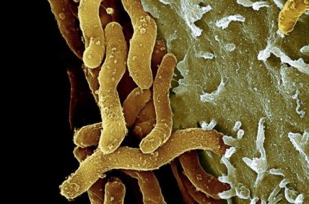 Πώς το Πάσχα βοήθησε να καταρριφθεί ο μύθος για το έλκος