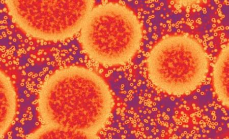 Ο νοροϊός μεταδίδεται μέσω του αέρα