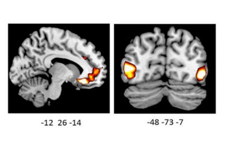 Γονίδιο «διαμορφώνει τις συναισθηματικές αντιδράσεις»
