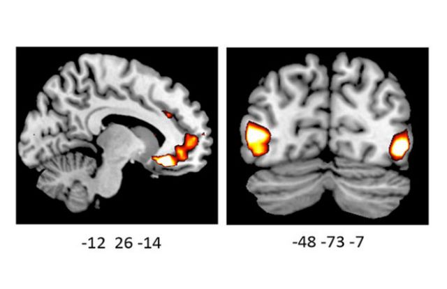 Γονίδιο «διαμορφώνει τις συναισθηματικές αντιδράσεις»