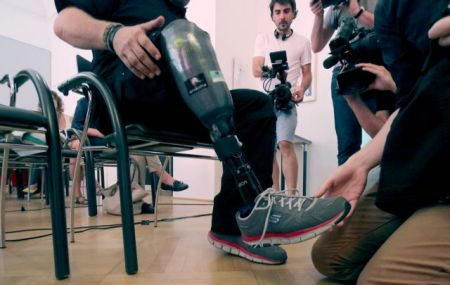 Το πρώτο τεχνητό μέλος που αισθάνεται