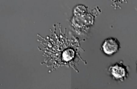 Ο θάνατος ενός λευκού αιμοσφαιρίου