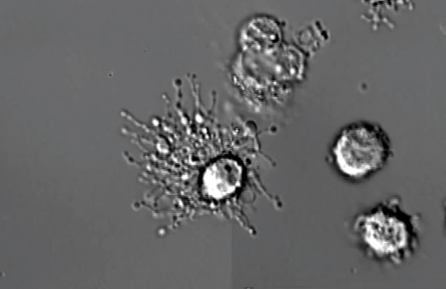 Ο θάνατος ενός λευκού αιμοσφαιρίου