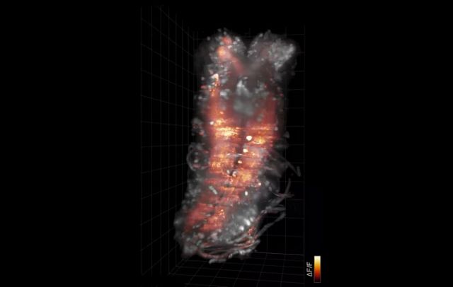 Βίντεο: Ένα νευρικό σύστημα λάμπει εν δράσει