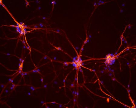 Εκατοντάδες μεταλλάξεις σε κάθε νευρώνα του εγκεφάλου