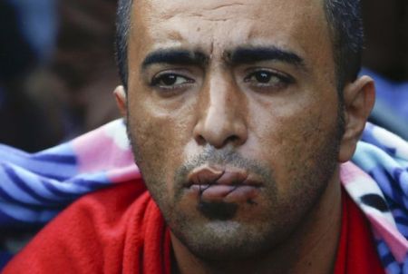 Ειδομένη: Πρόσφυγες έραψαν τα στόματά τους